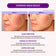 10% Niacinamide & 1.9% Salicylic Acid Oil Control Serum Moira