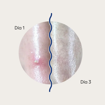 Curadots de Cureativa PM
